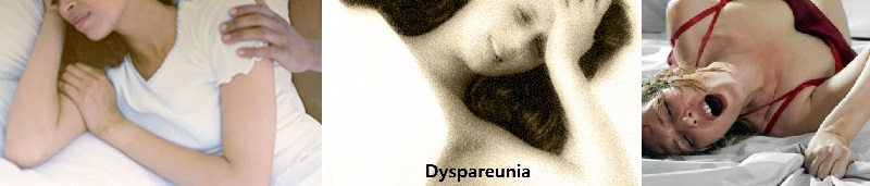 Dyspareunia final